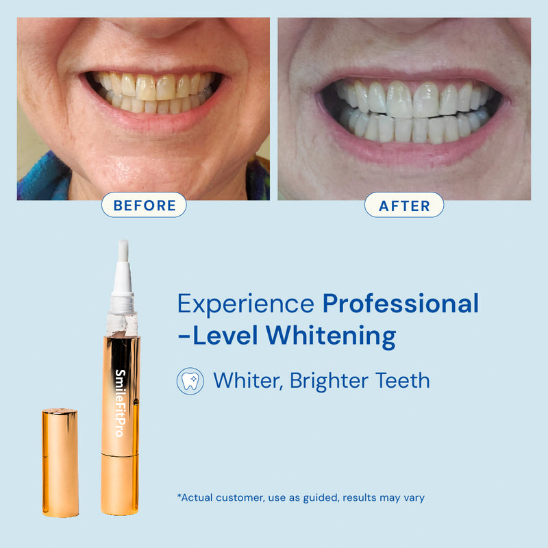 Extra-Strength Teeth Whitening Serum Pen + Dual-Peroxide Formula & Xylitol